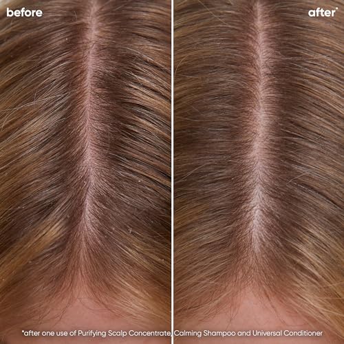 Biolage Scalp Sync Calming Shampoo for Dry or Irritated Scalp, Vegan & Cruelty Free O7138